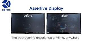 assertive_display_xbox_thumbnail