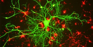Neuron_in_tissue_culture