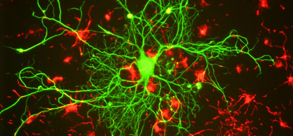 Neurologists are Criticizing Gaming, and Here’s Why